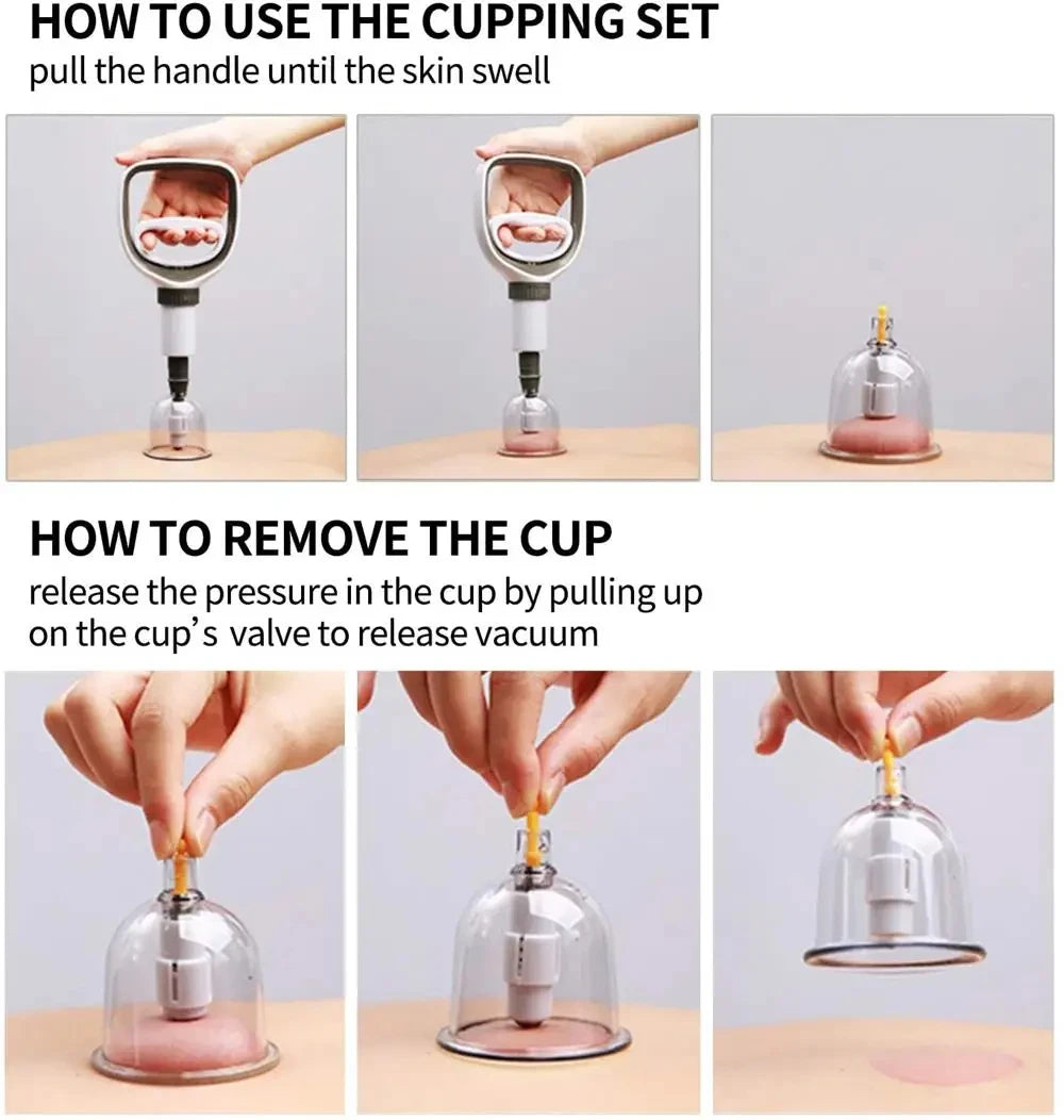 Cupping Therapy Set – Vacuum Suction Cups for Body Massage & Cellulite Relief