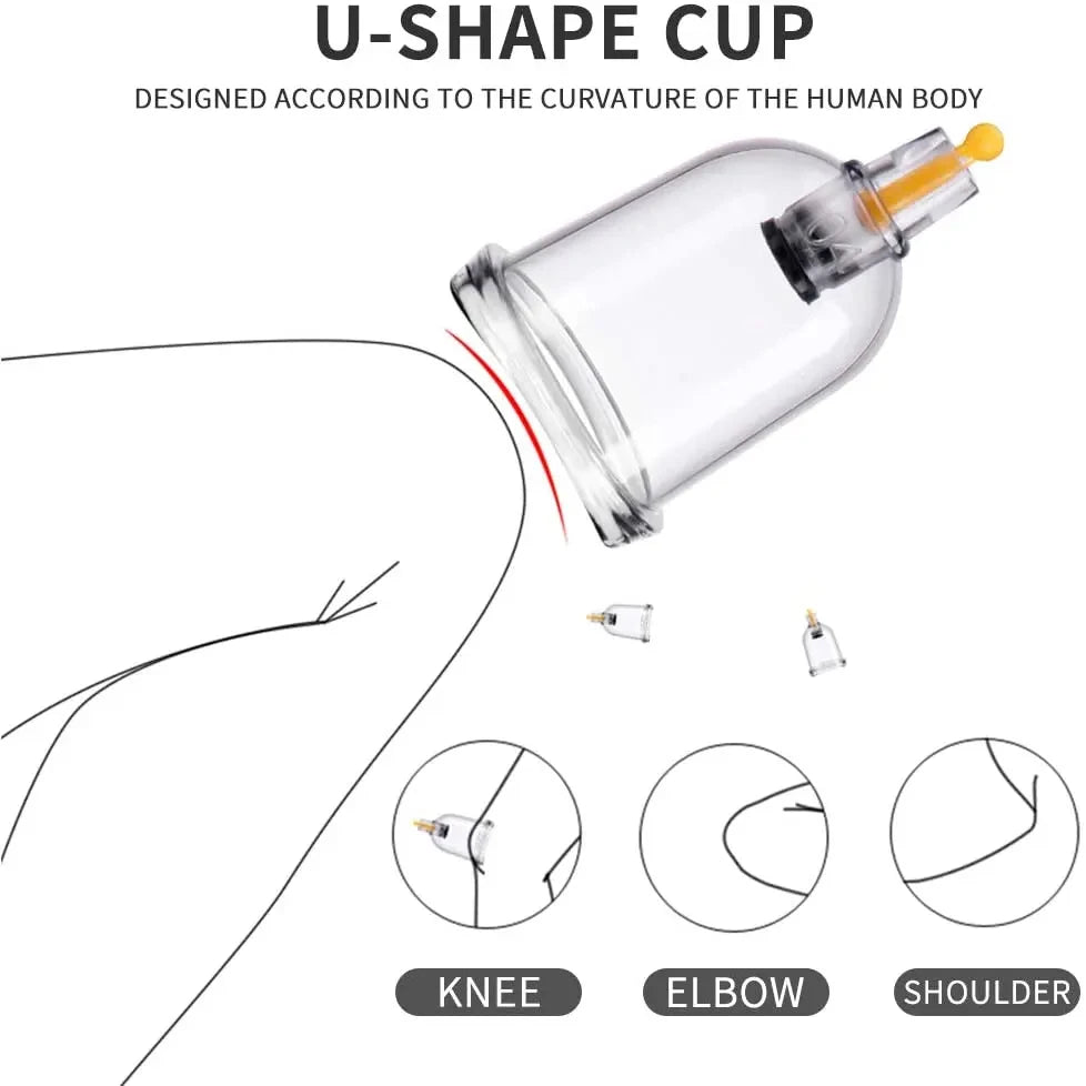 Cupping Therapy Set – Vacuum Suction Cups for Body Massage & Cellulite Relief