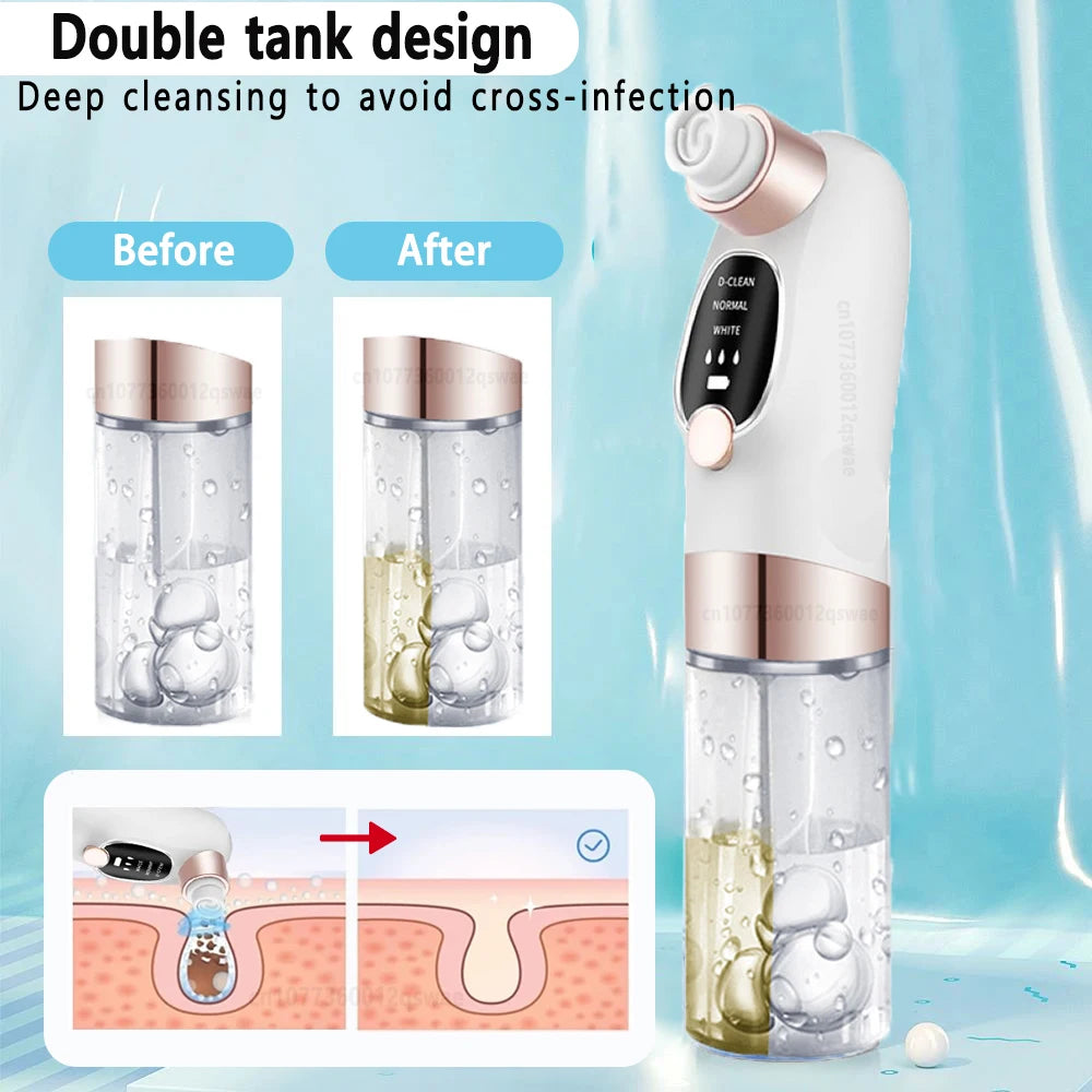 Electric Blackhead Remover Pore Vacuum – USB Rechargeable Water Cycle Facial Cleaner