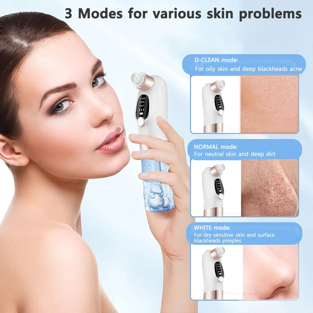 Electric Blackhead Remover Pore Vacuum – USB Rechargeable Water Cycle Facial Cleaner