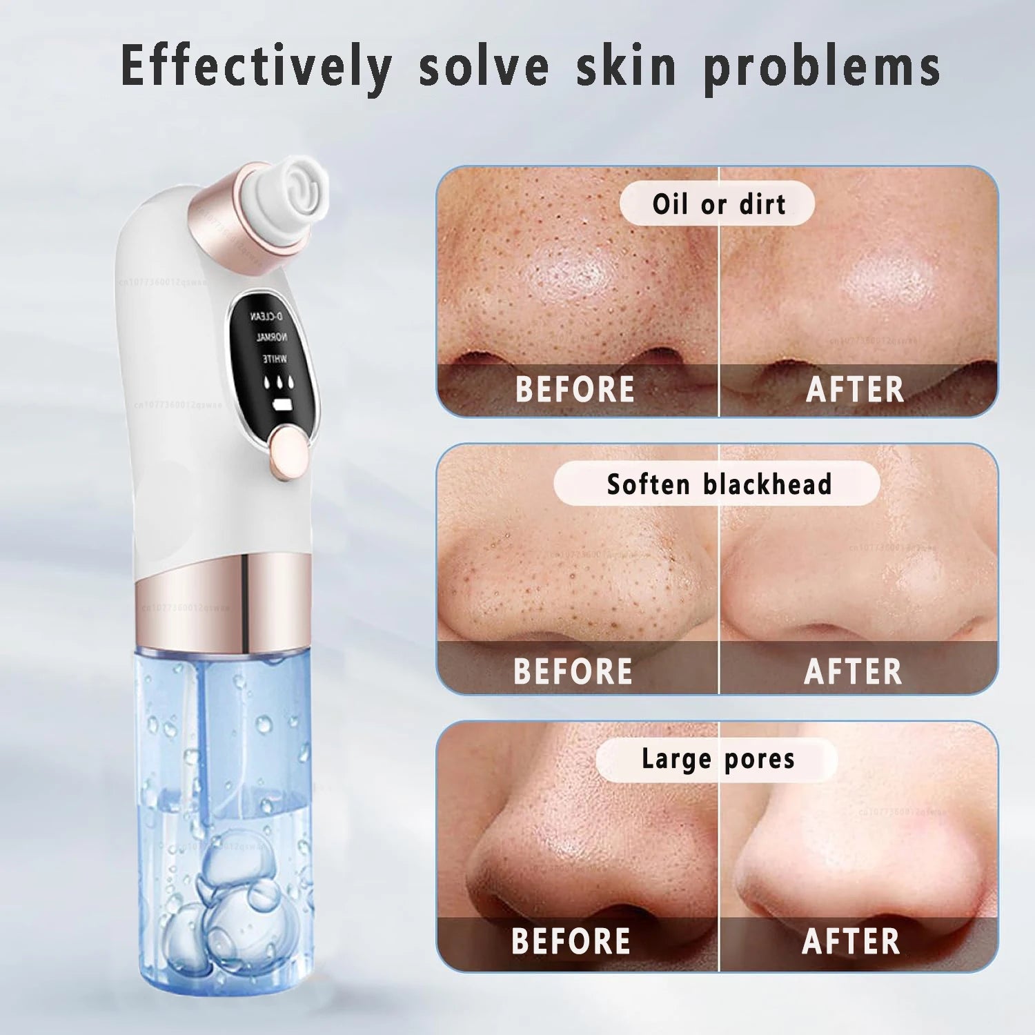 Electric Blackhead Remover Pore Vacuum – USB Rechargeable Water Cycle Facial Cleaner