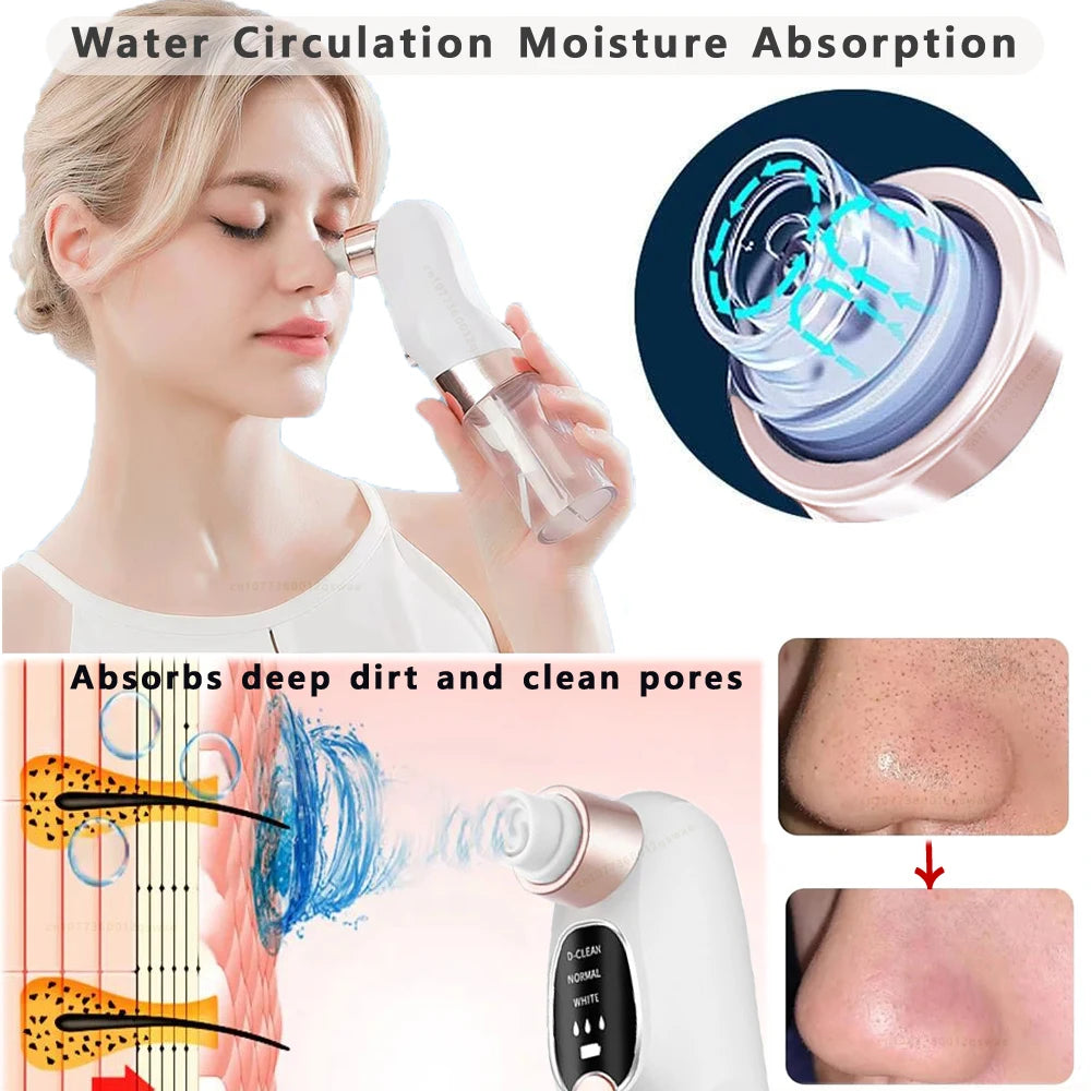 Electric Blackhead Remover Pore Vacuum – USB Rechargeable Water Cycle Facial Cleaner